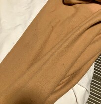 Only a fraction of all the hair we found attached to the sheets