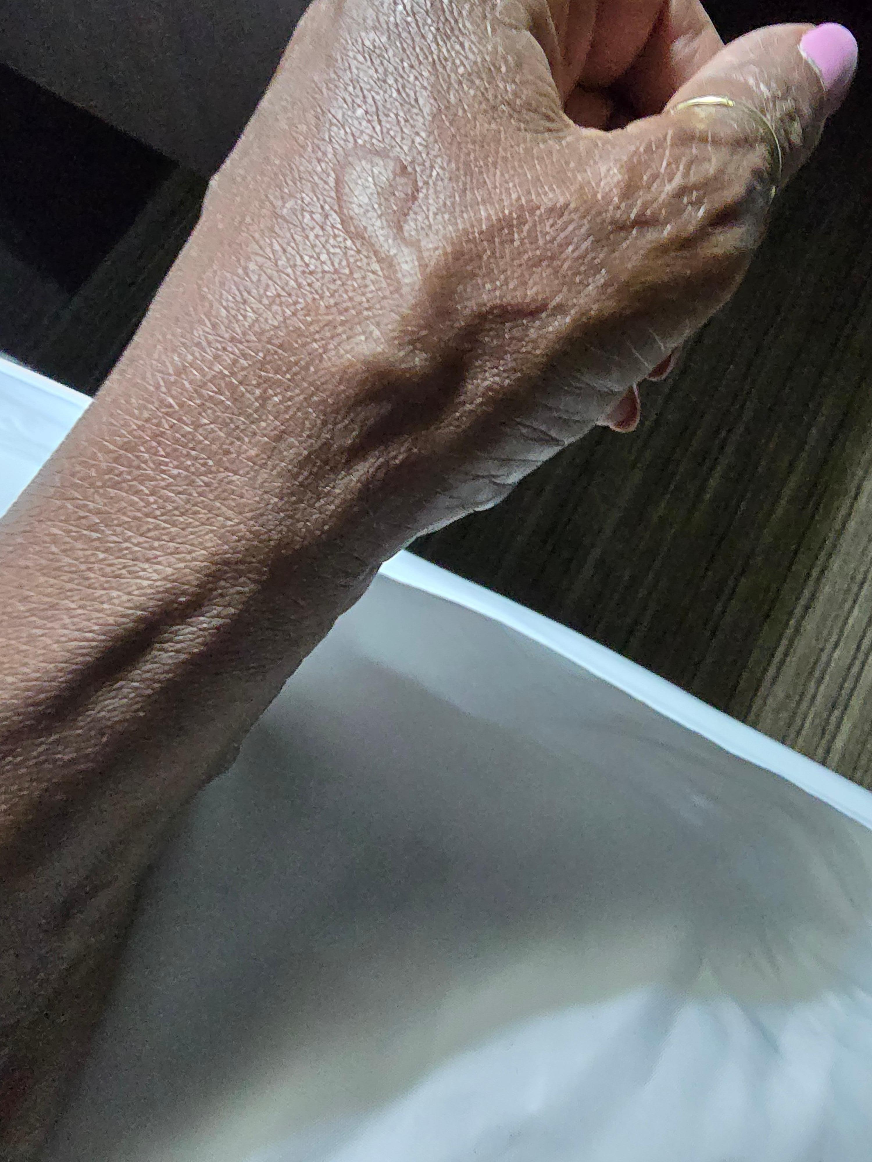 These bites awakened me and chased me from the hotel in the middle of the night 60 miles from home. The manager is refusing to refund me.