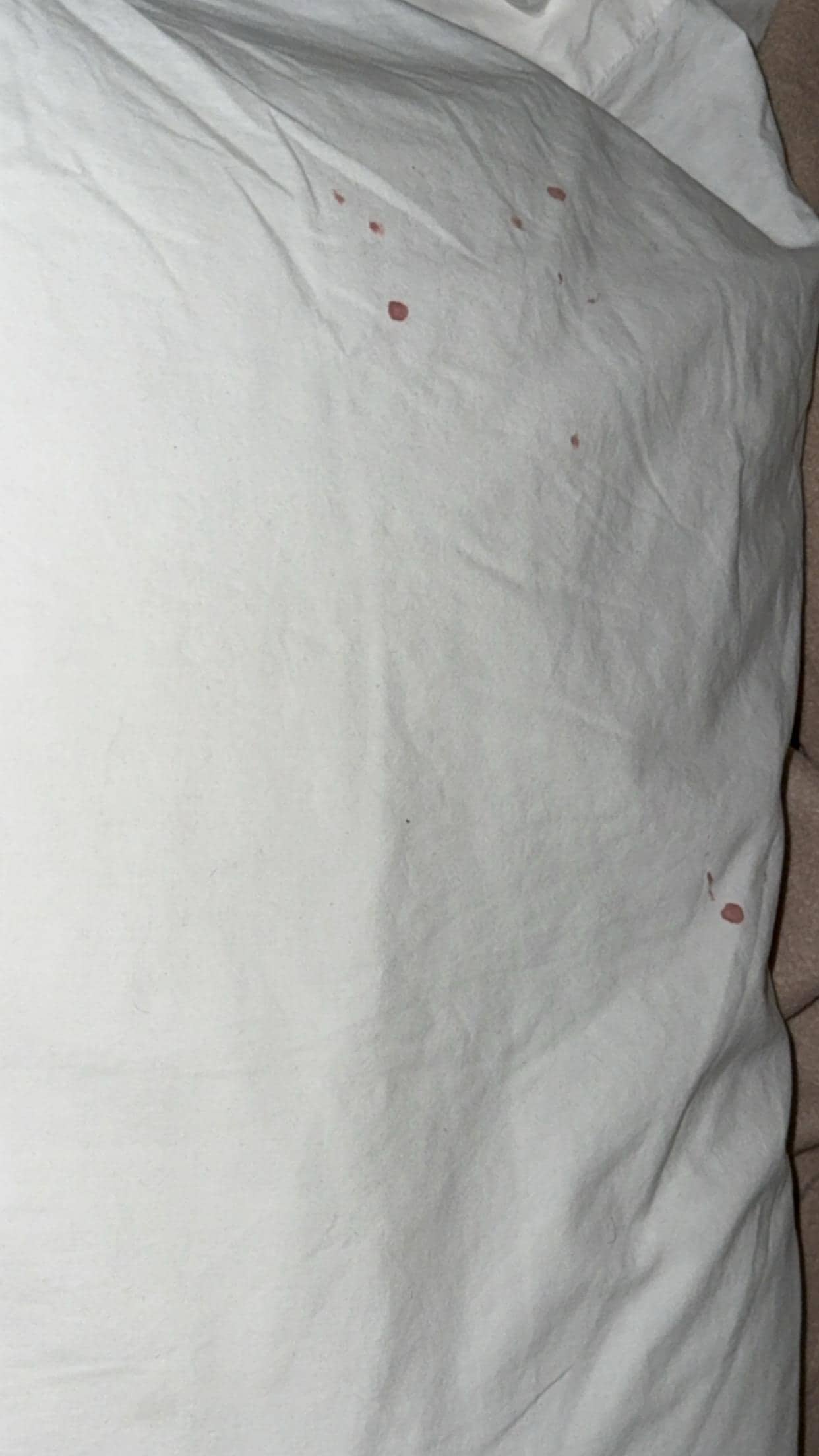 There was blood stains on the pillows 