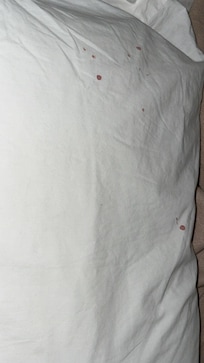 There was blood stains on the pillows