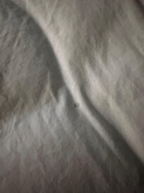 Is that dried blood?