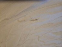 Filthy sheets with bodily fluid stains.