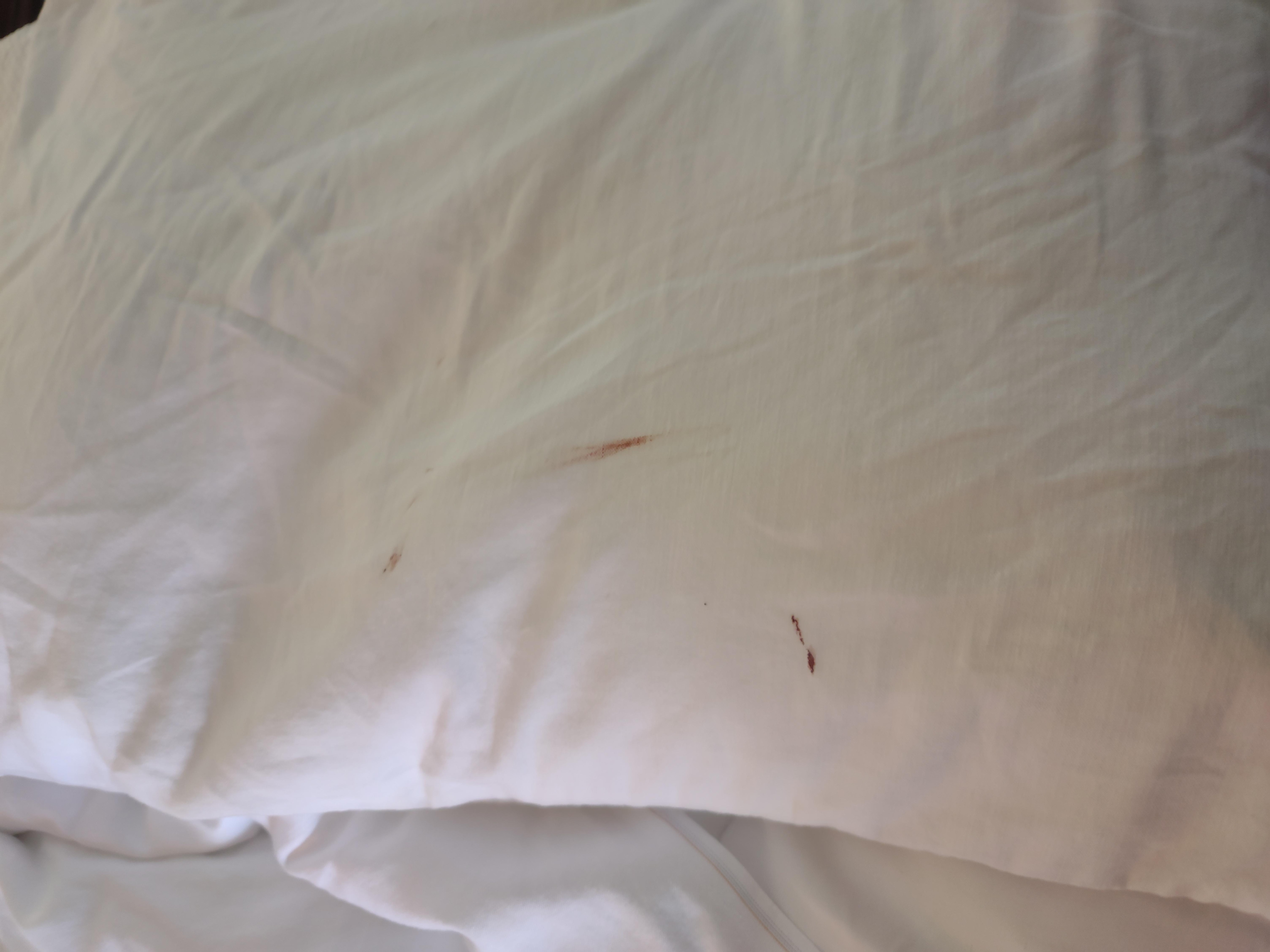 Blood smears and spots in pillow case