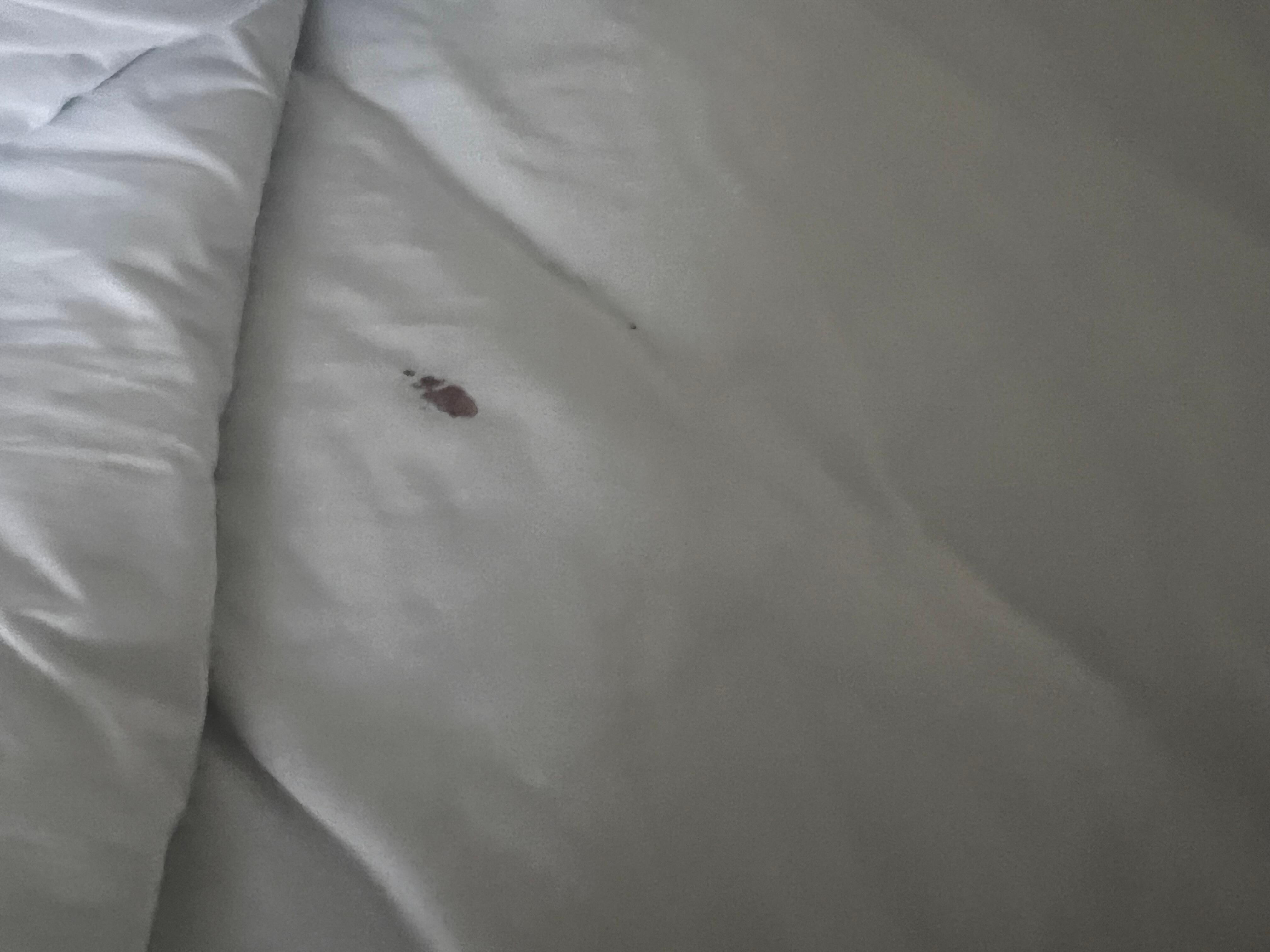 Sheet had dried blood on them. 