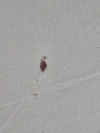 Blood stain on bottom sheet of the bed