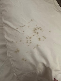 Mold on pillowcase