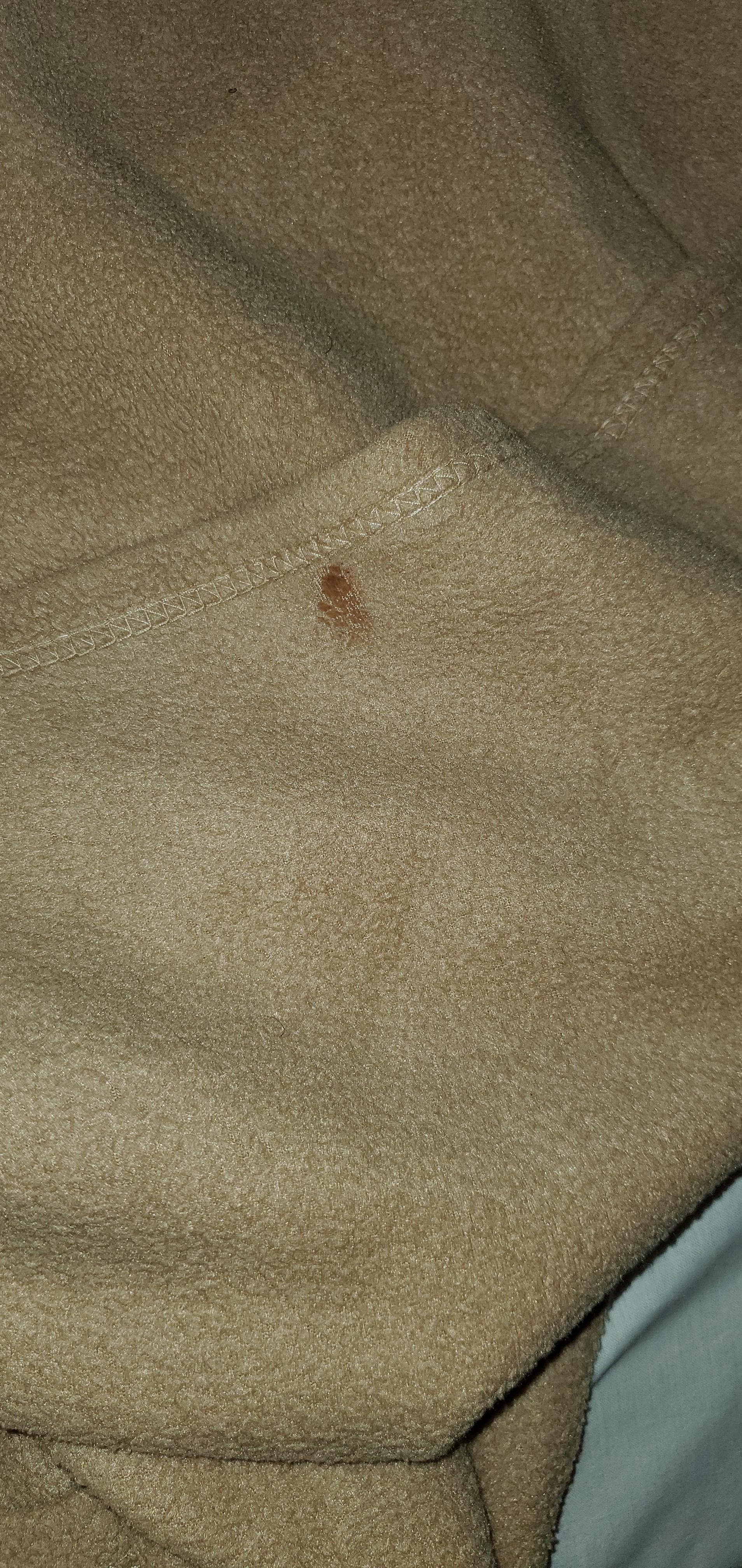 Stained fabric... Disgusting bedding.