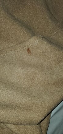 Stained fabric... Disgusting bedding.
