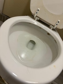Toilet the black mold under rim