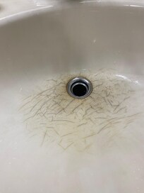 Cracked dirty sink