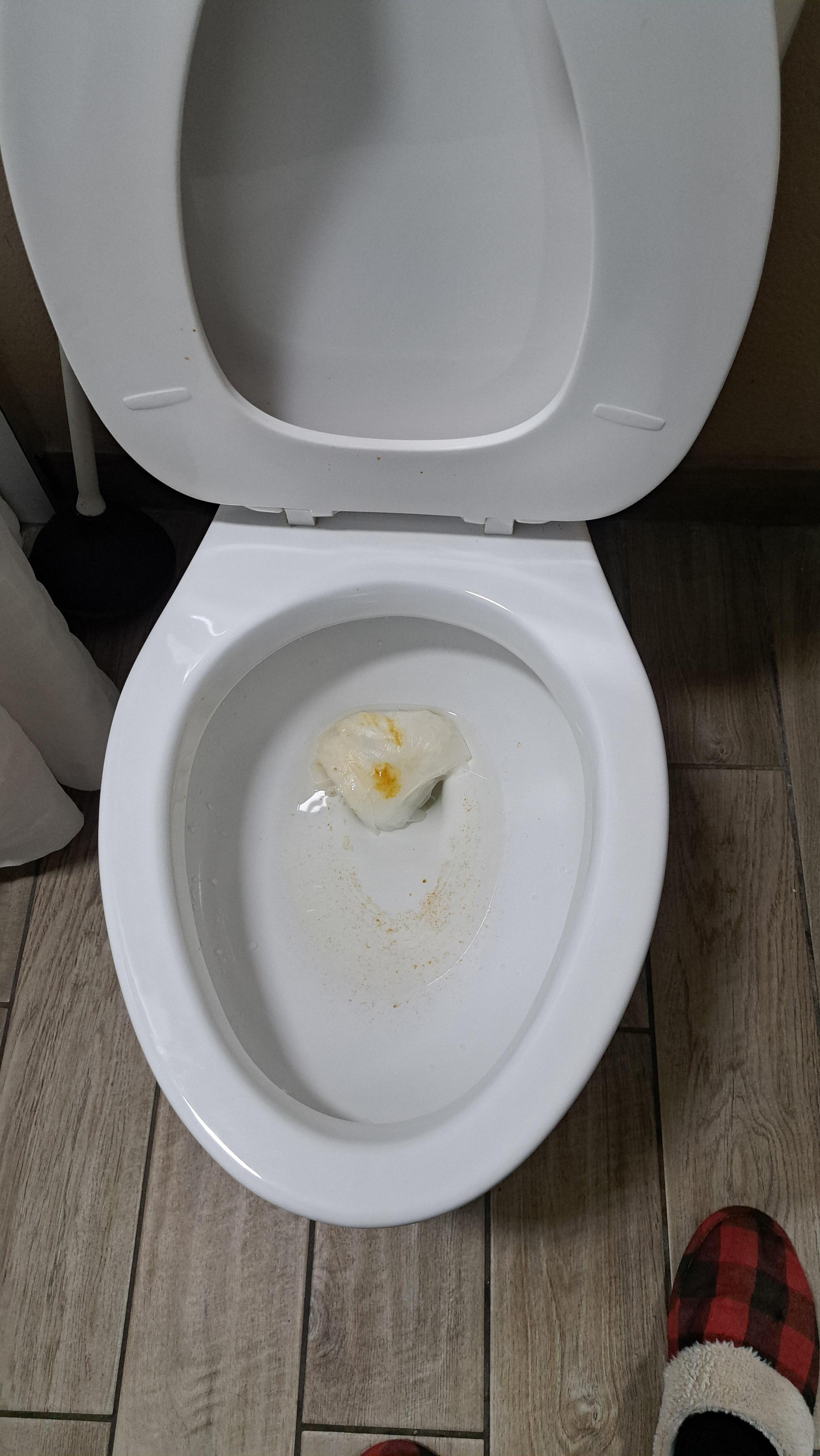 Toilet won't flush 
