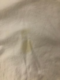 Stains on bed