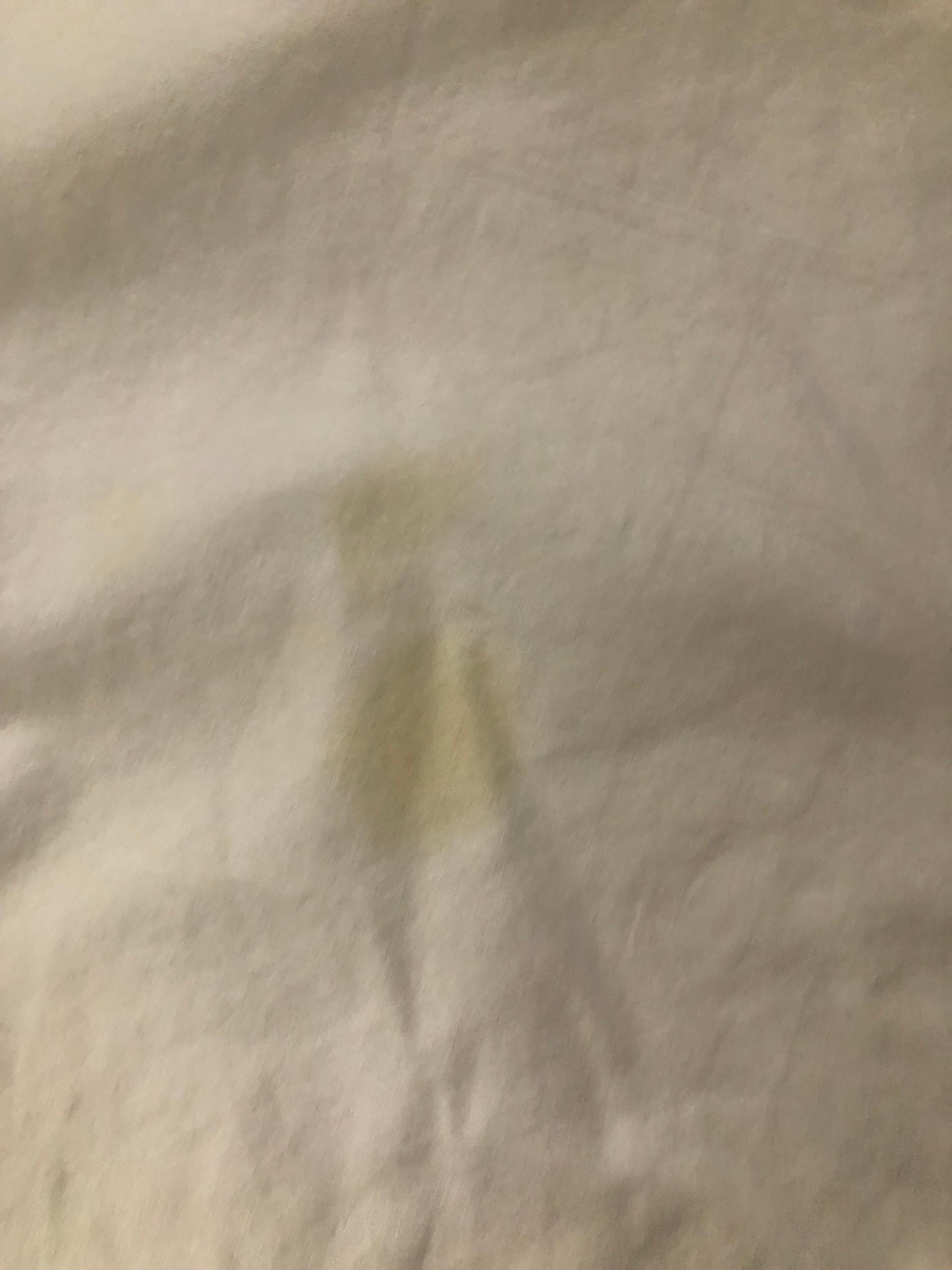 Stains on bed