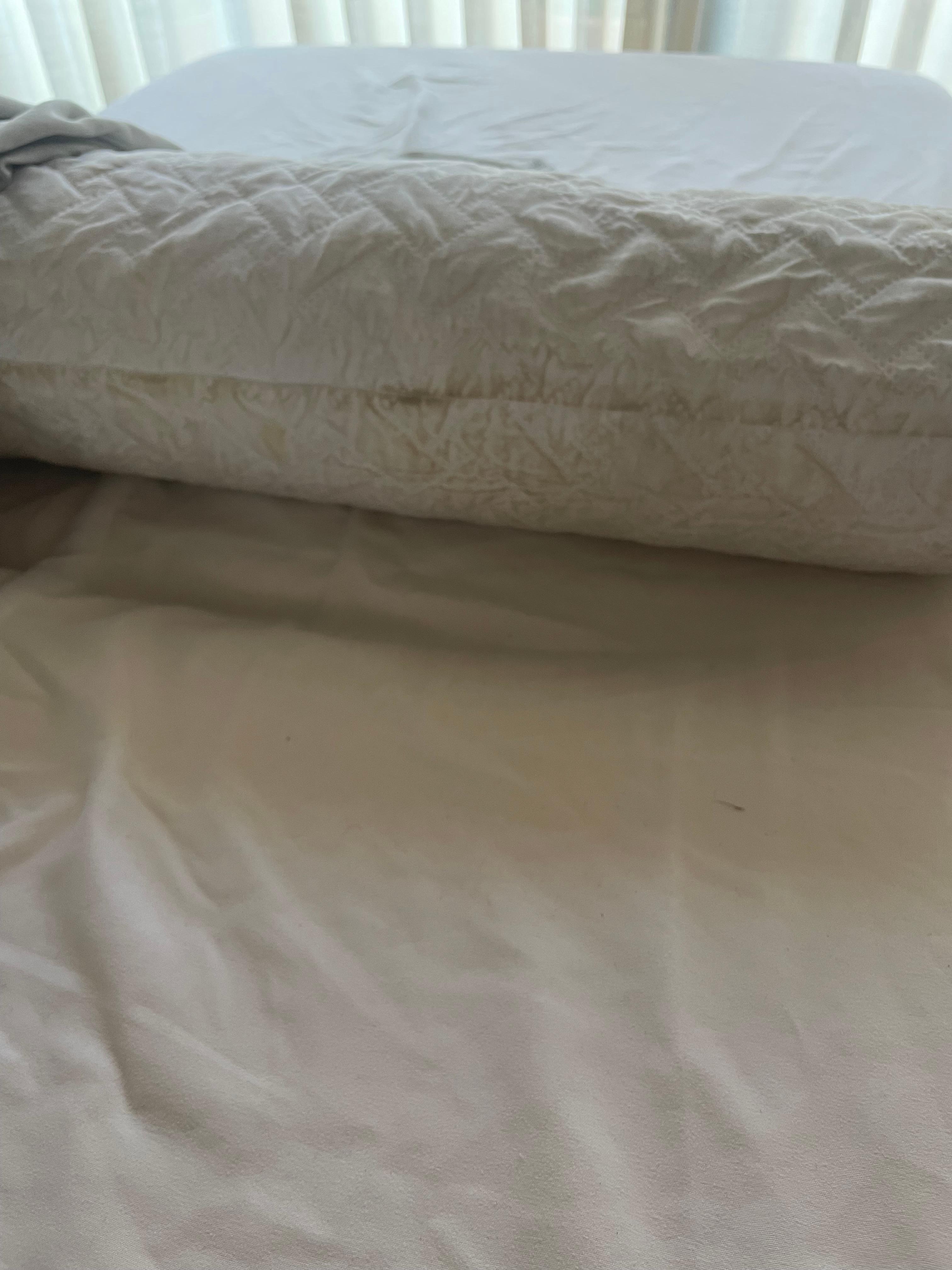 the filthy massage roll that was used (without a towel)again my skin)!