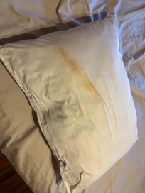 Bedding issue