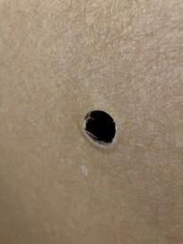 Hole on wall next to bed