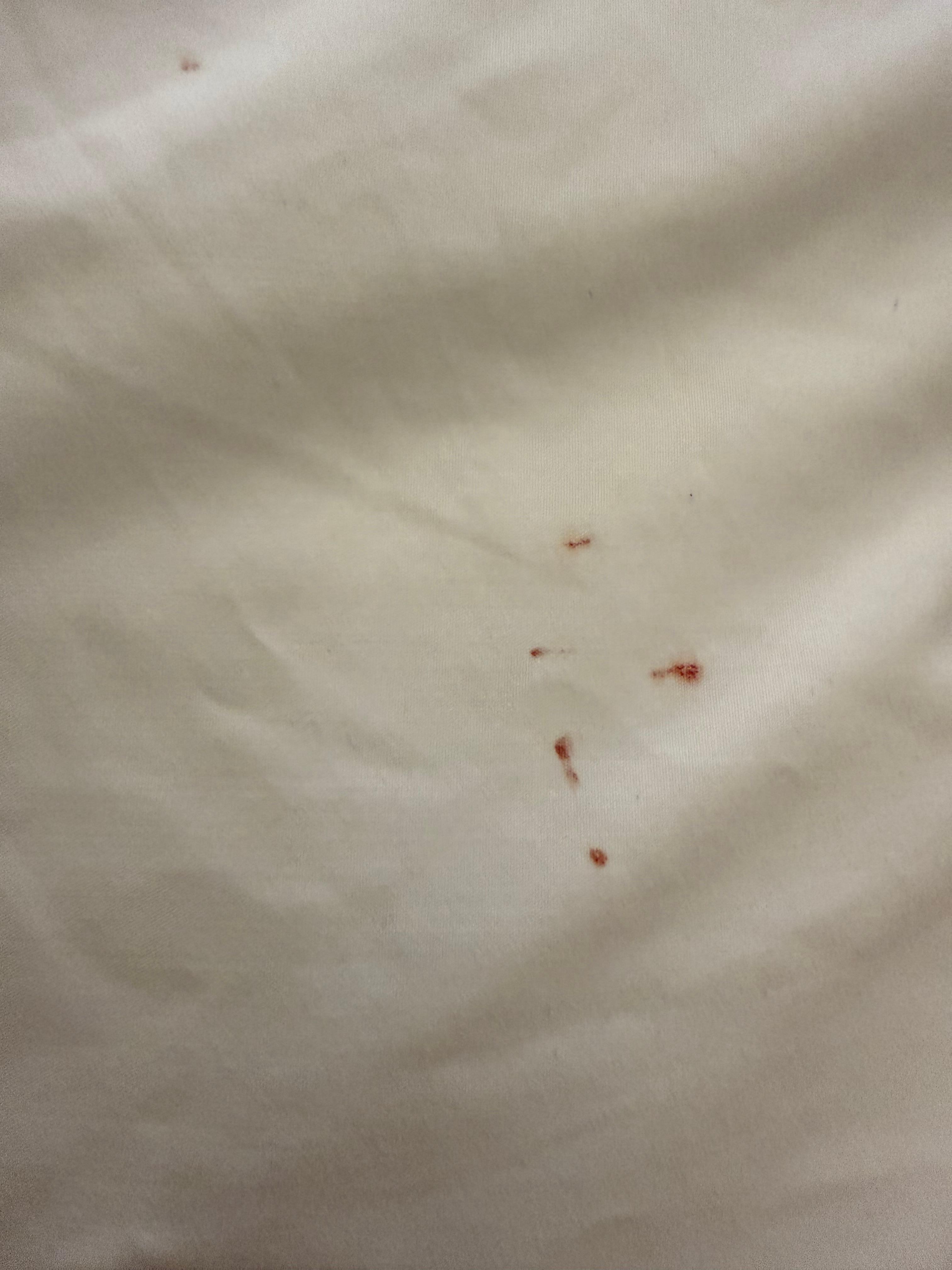 Blood on pillows we reported to the staff