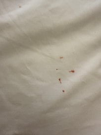 Blood on pillows we reported to the staff