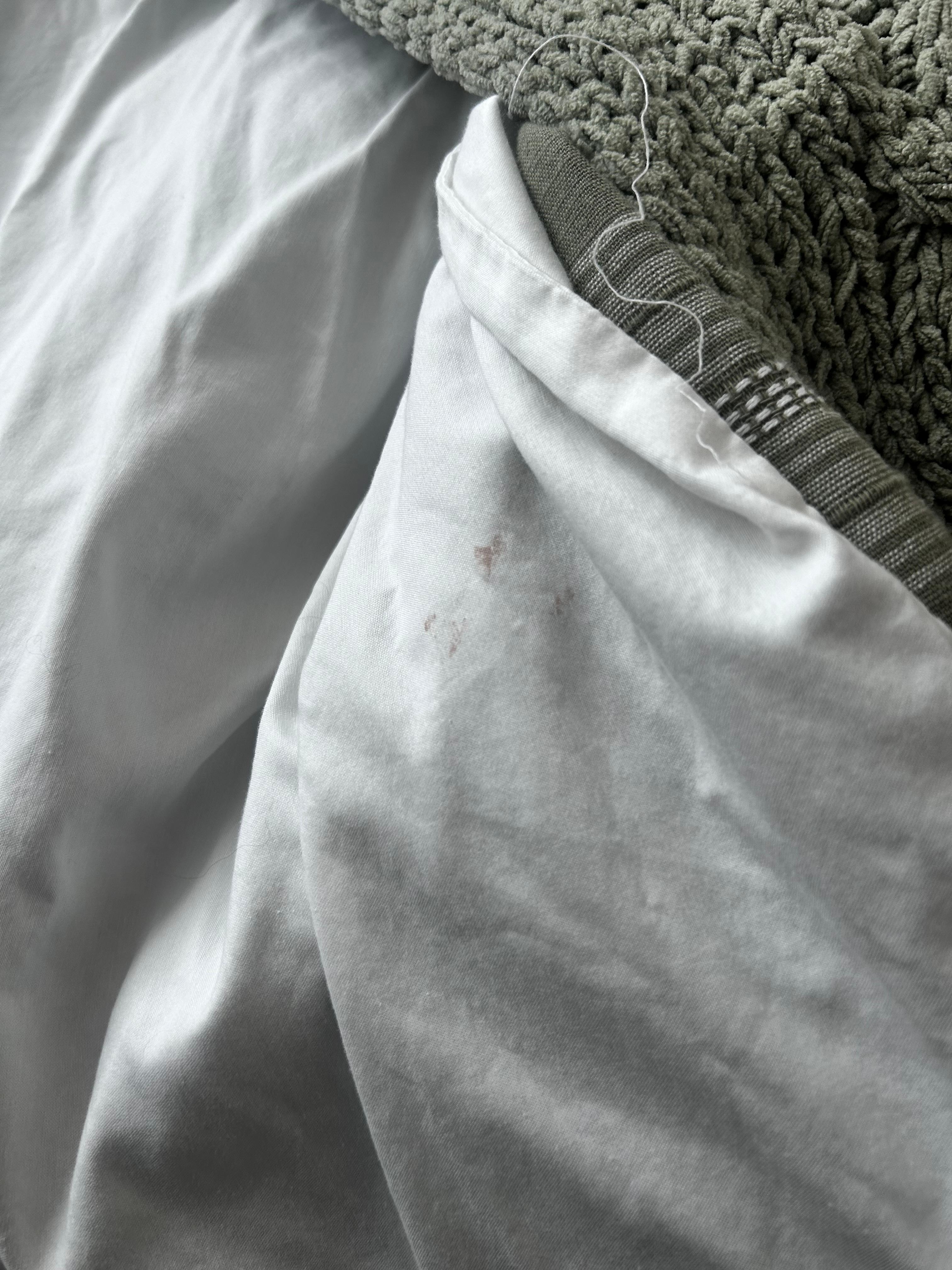 Stain on sheets
