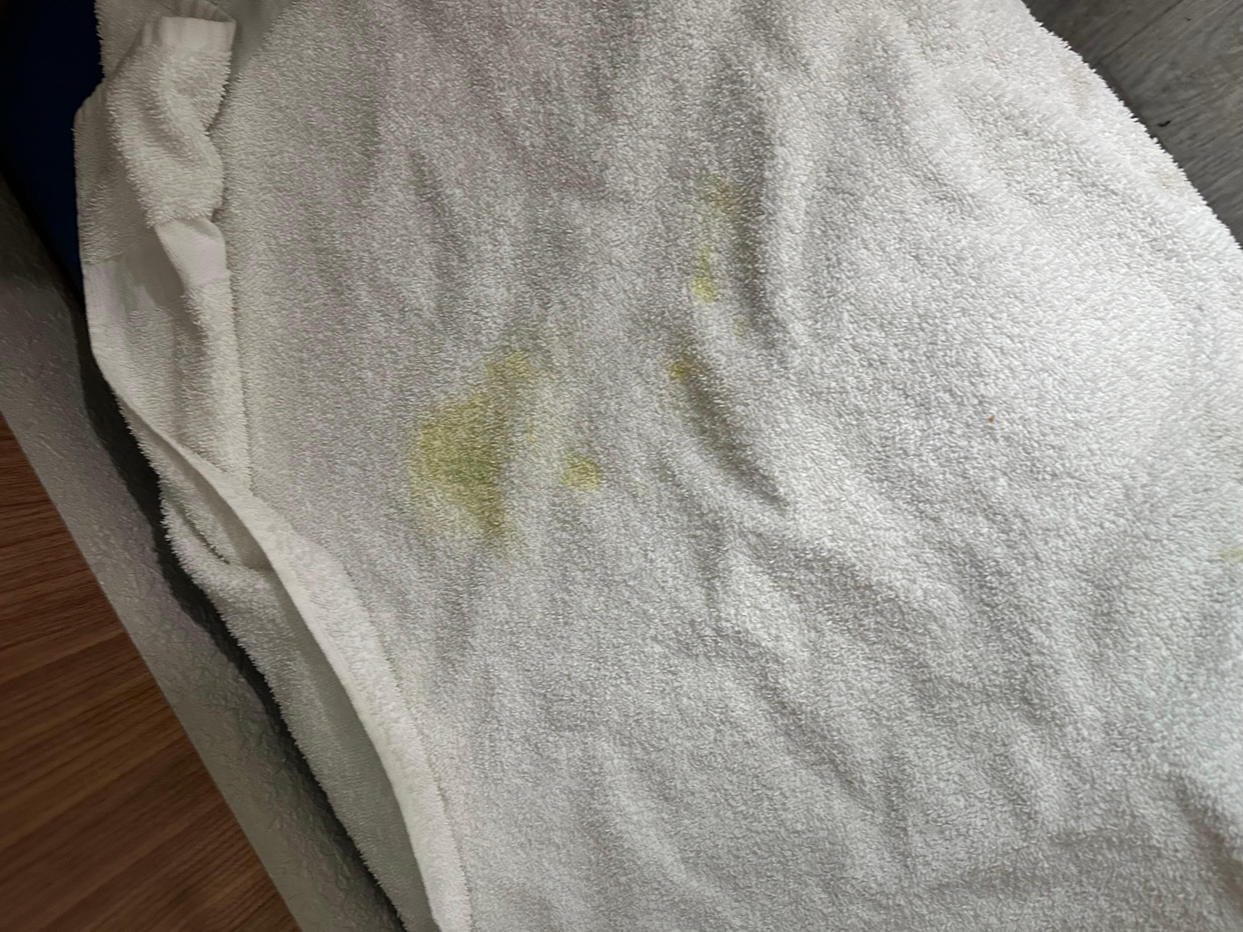 Yellow stains in the towels 