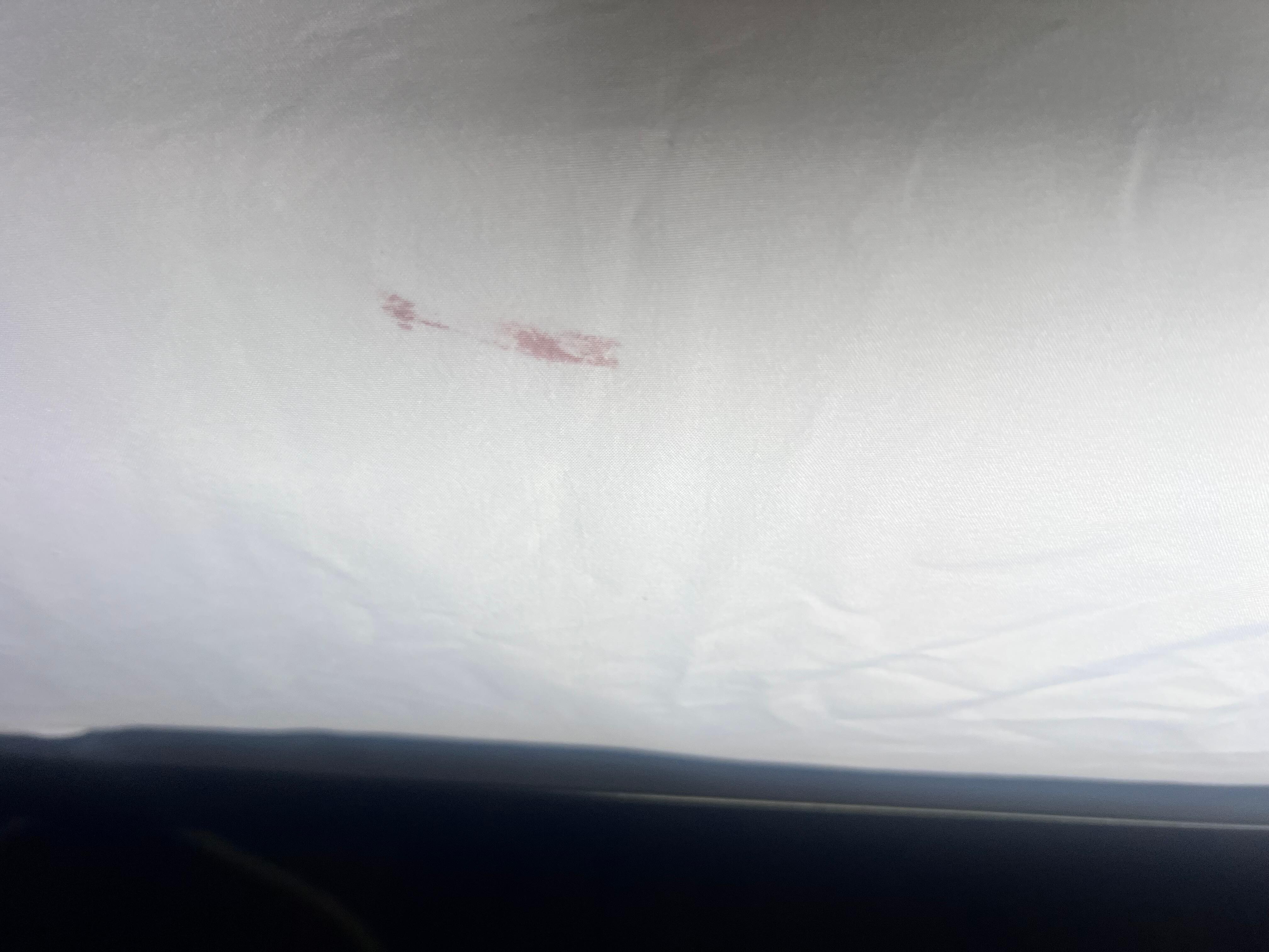 Something on the sheet the Sam wine too with the hole… like how much damage should one have to deal with on one sheet.