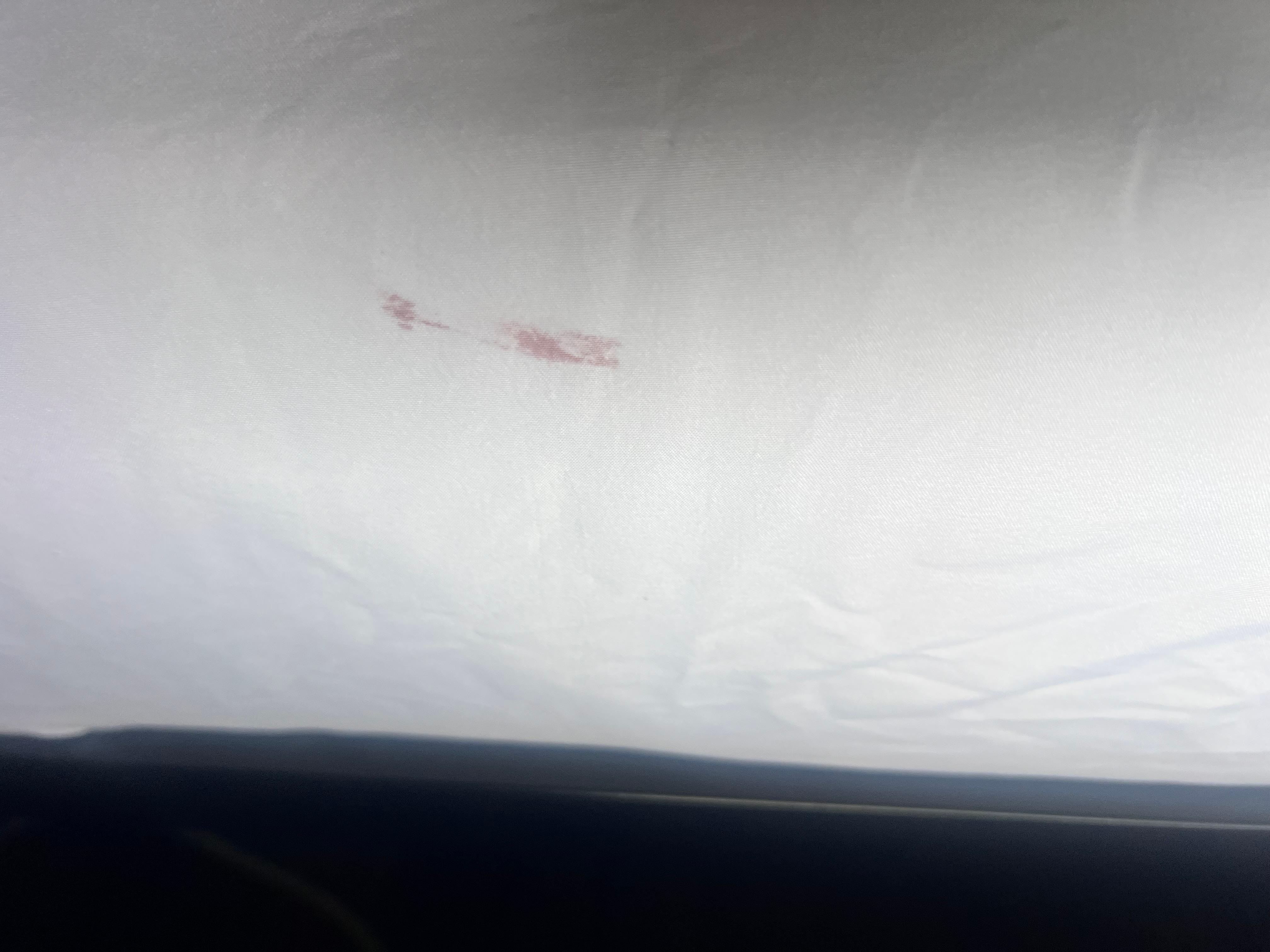 Something on the sheet the Sam wine too with the hole… like how much damage should one have to deal with on one sheet.