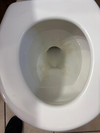 Stained toilet
Before
