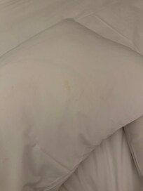 Another stained pillowcase