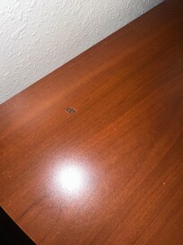 This just looks like a booger. Or food residue.