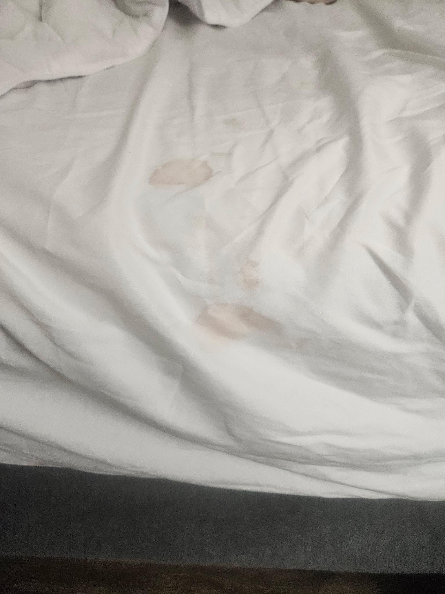 Blood on sheets 