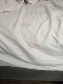Blood on sheets