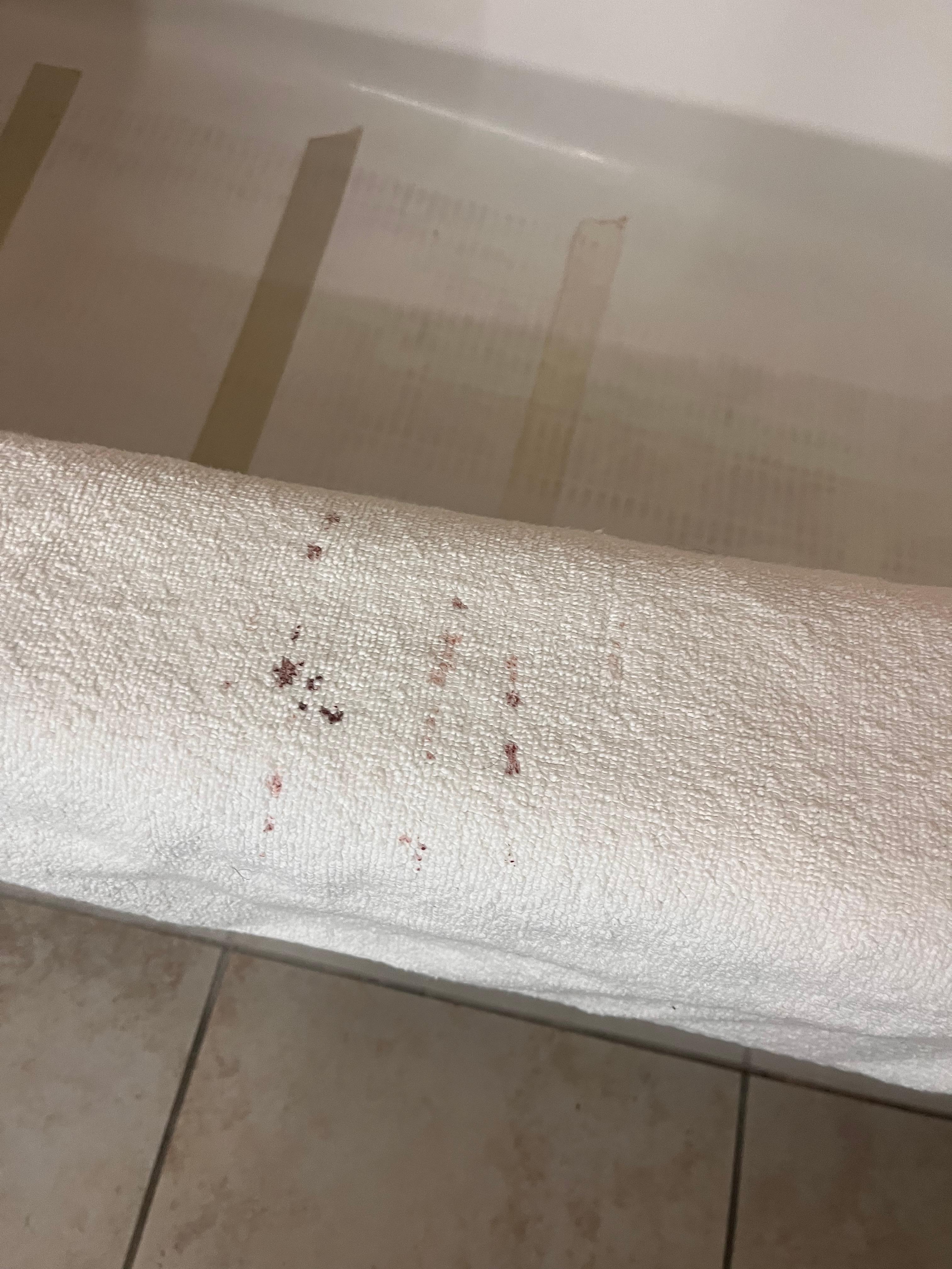 Appears to be a blood stain 