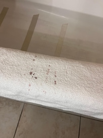 Appears to be a blood stain