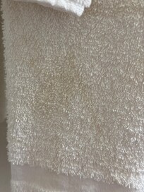 Stains on towels