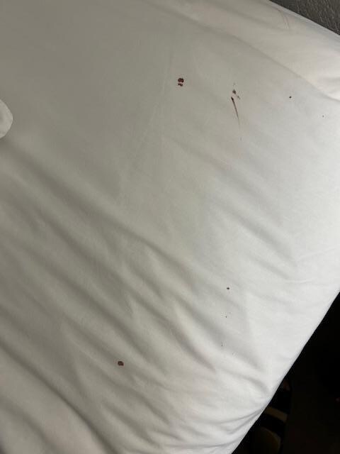 Blood smears on sheet
