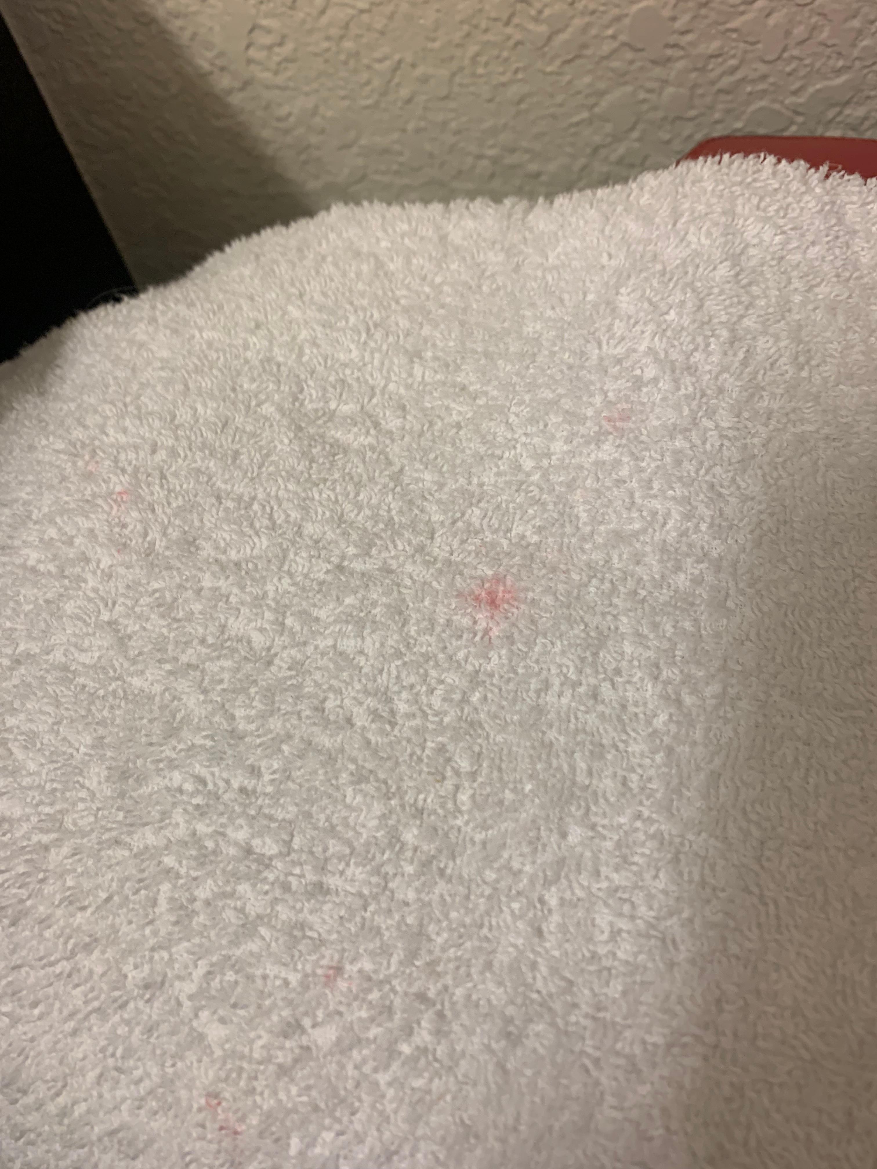 Stains on bath towel