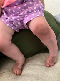 Dirt and grime on our 11-month old after crawling on the floor for 5 minutes.