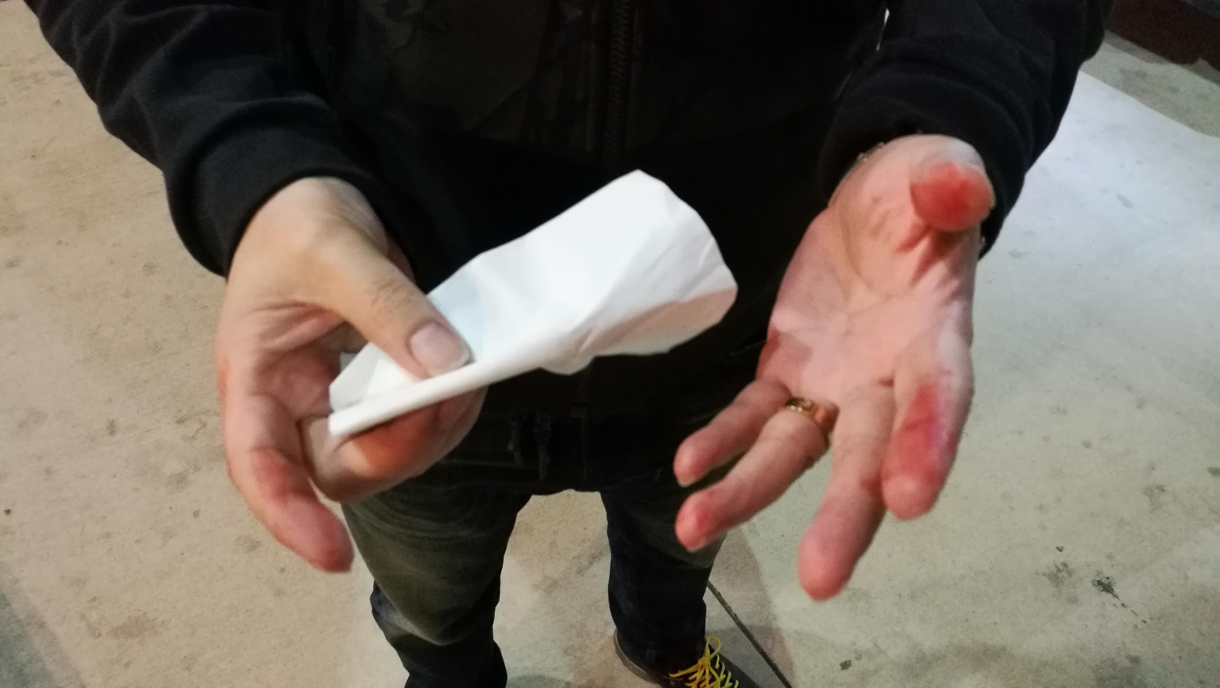 Damage