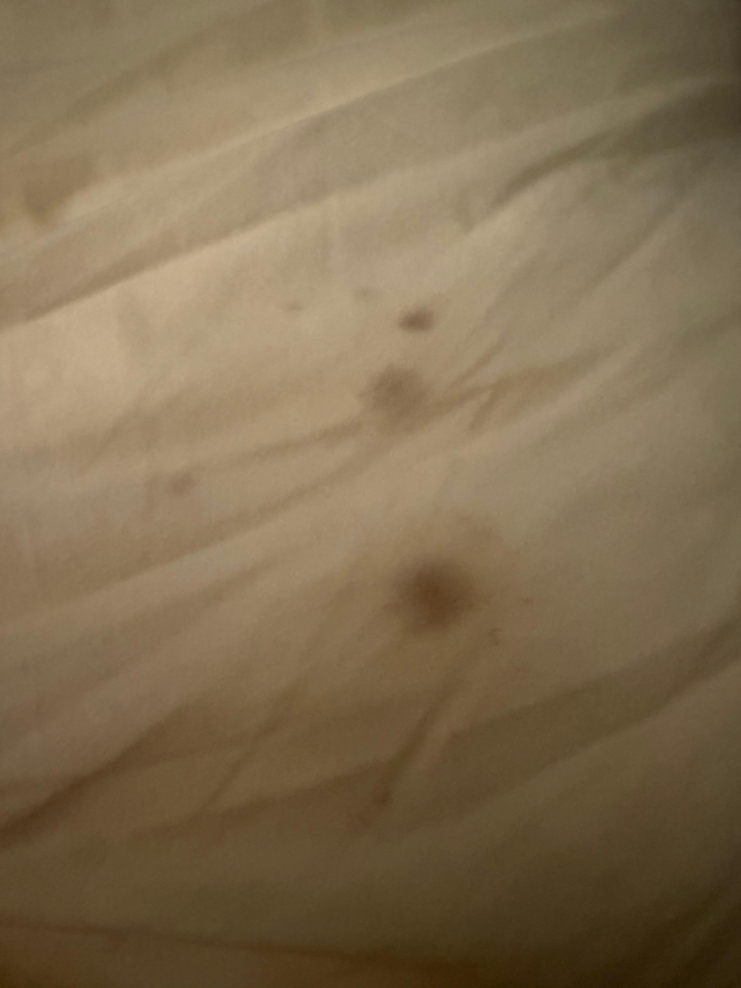 Spots on pillow