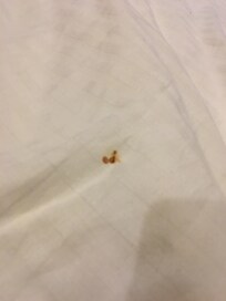 Stain on blanket