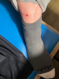 Ouch