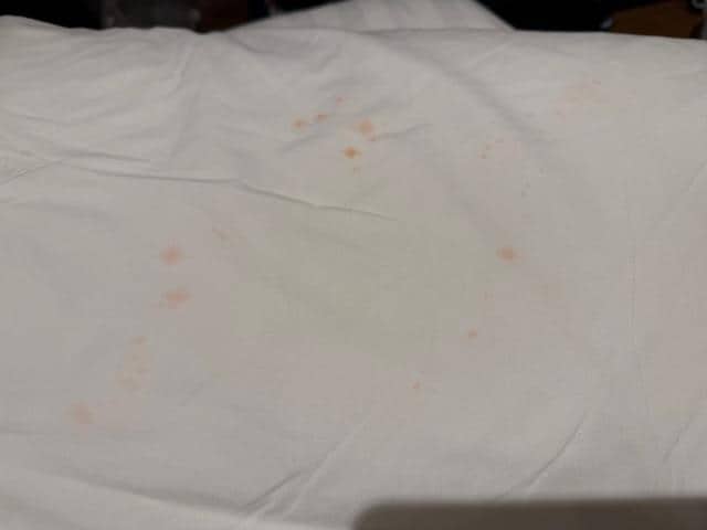Pillow with stains.