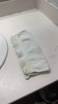 Towels were noticeably stained even before use.