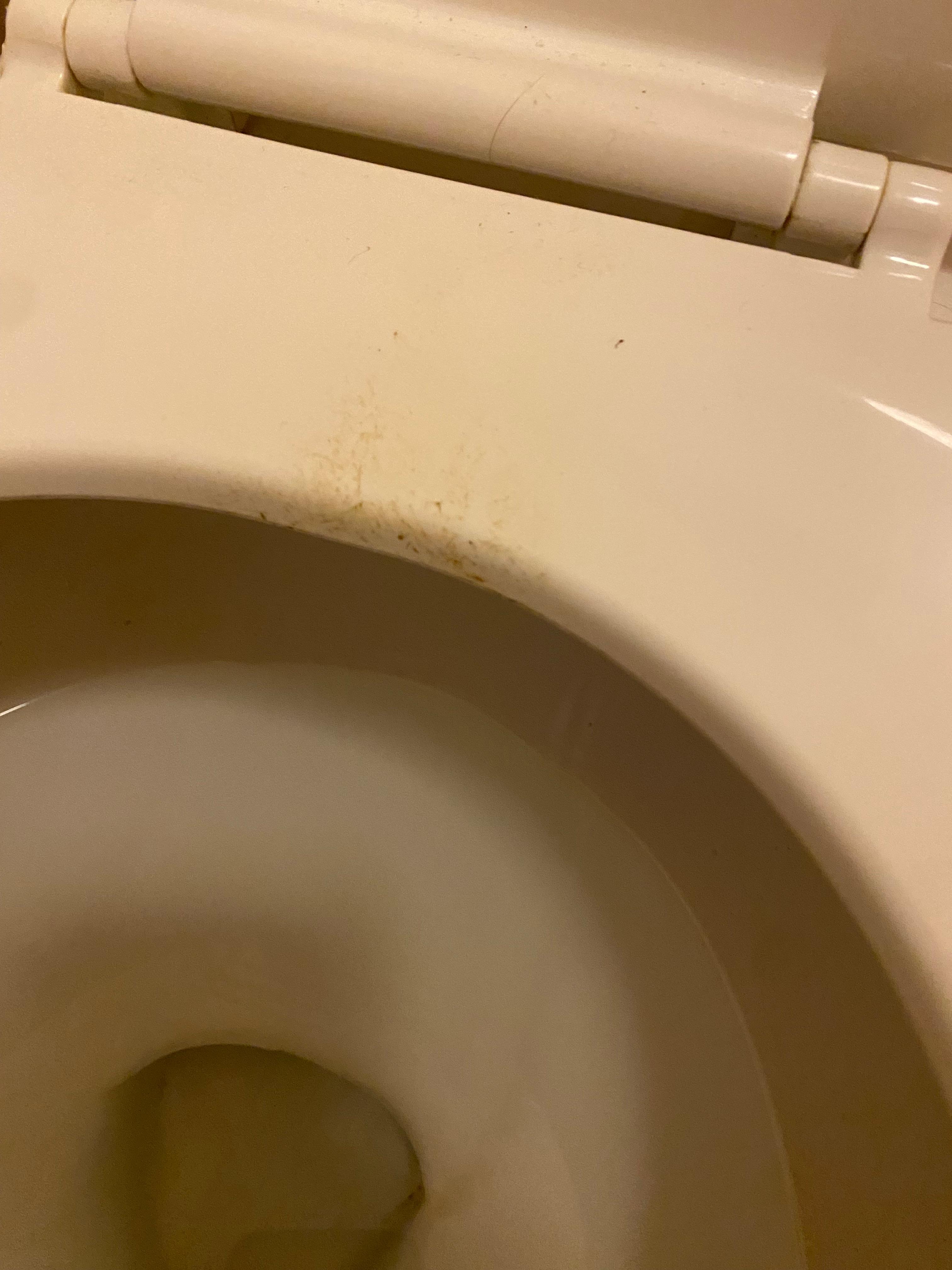 Poop residue