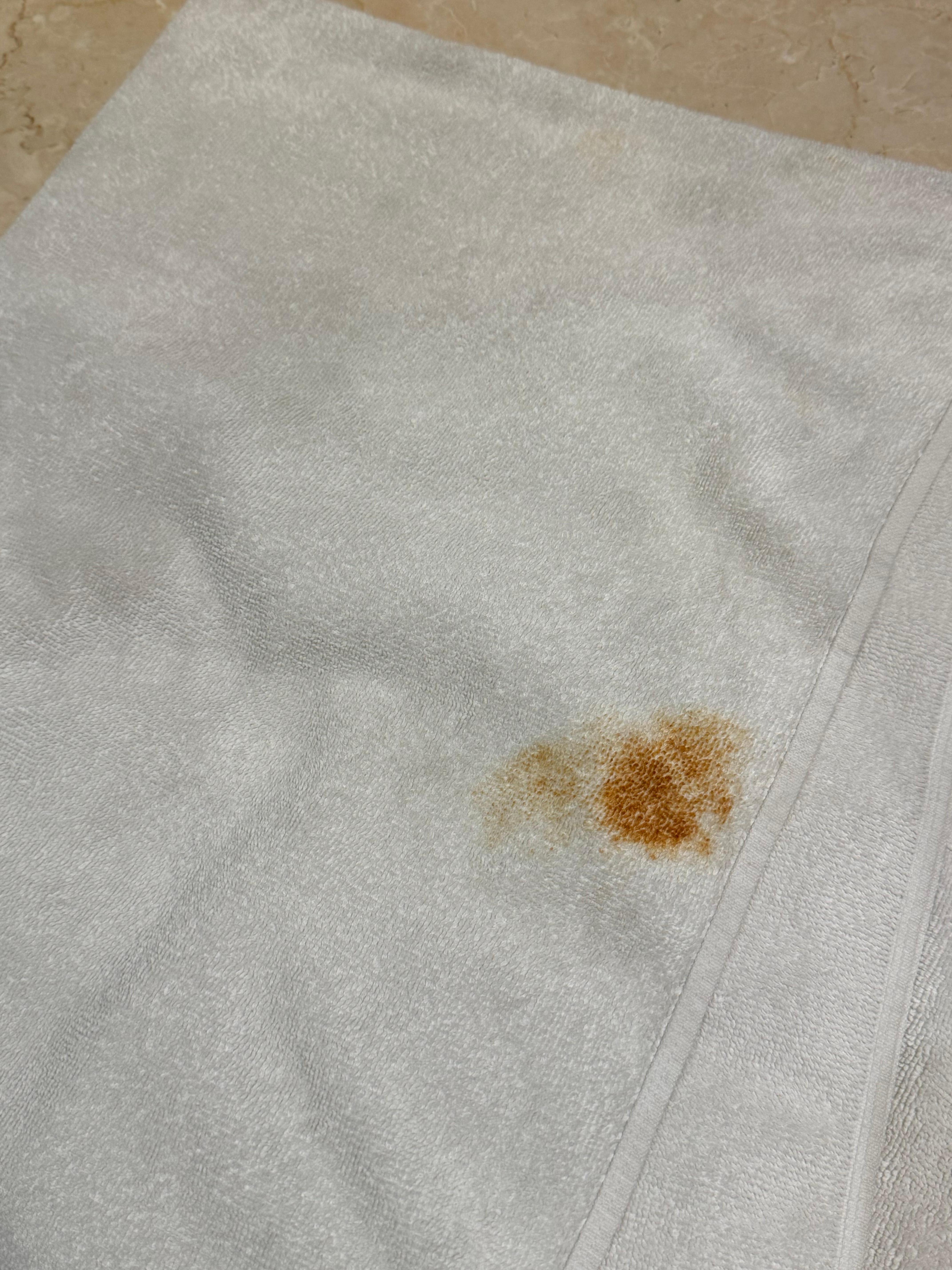 Pathetic condition of bath towels