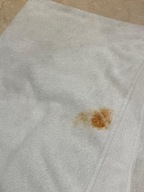 Pathetic condition of bath towels