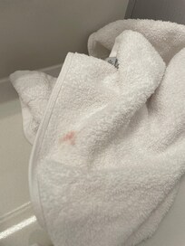 Black marks on sheets. (Difficult to see in this small picture)