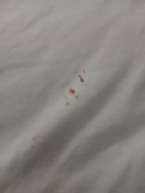 Stains on sheets