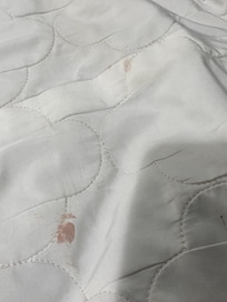 Looks like blood stains