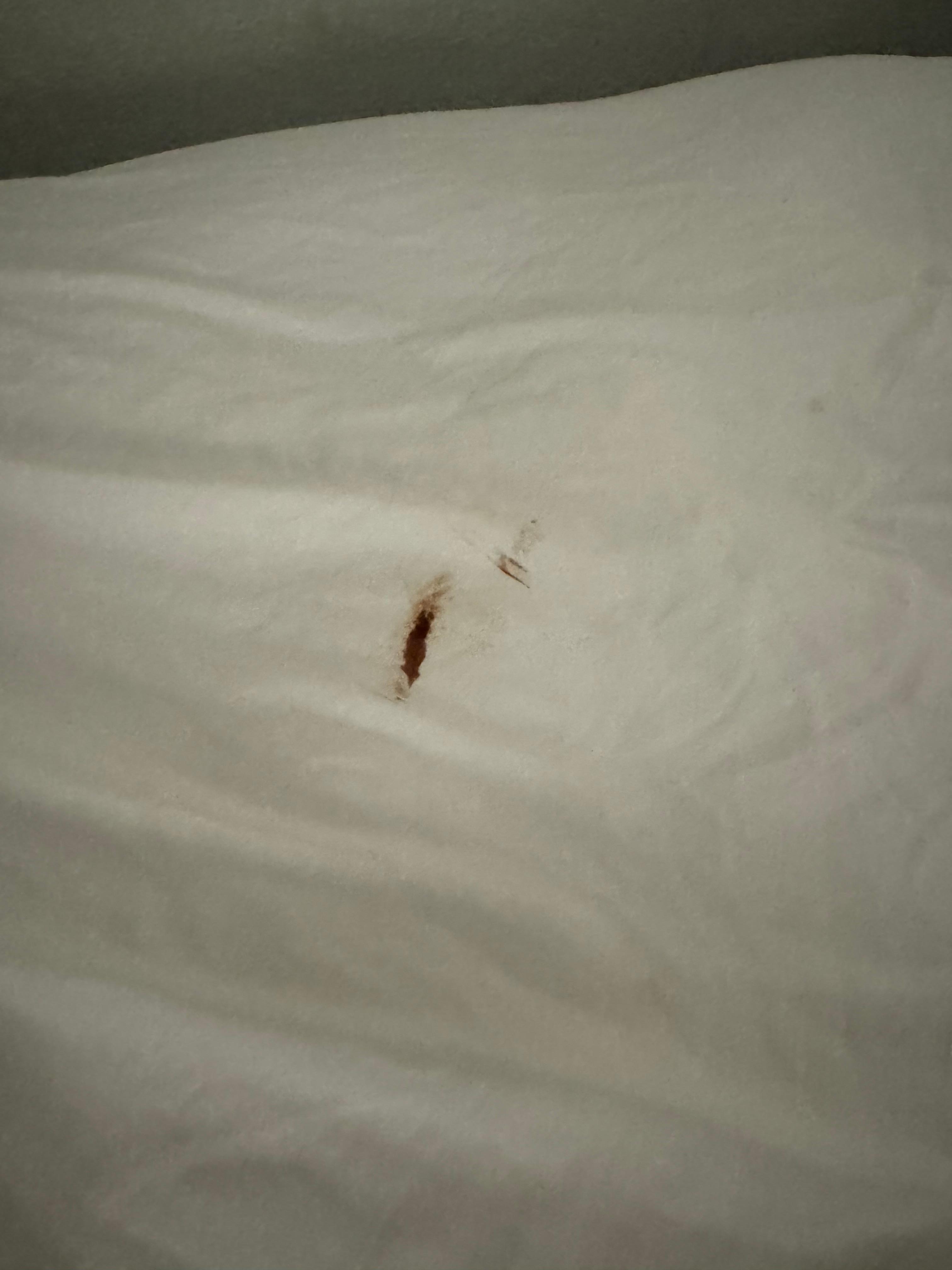 Stains on the bed sheets